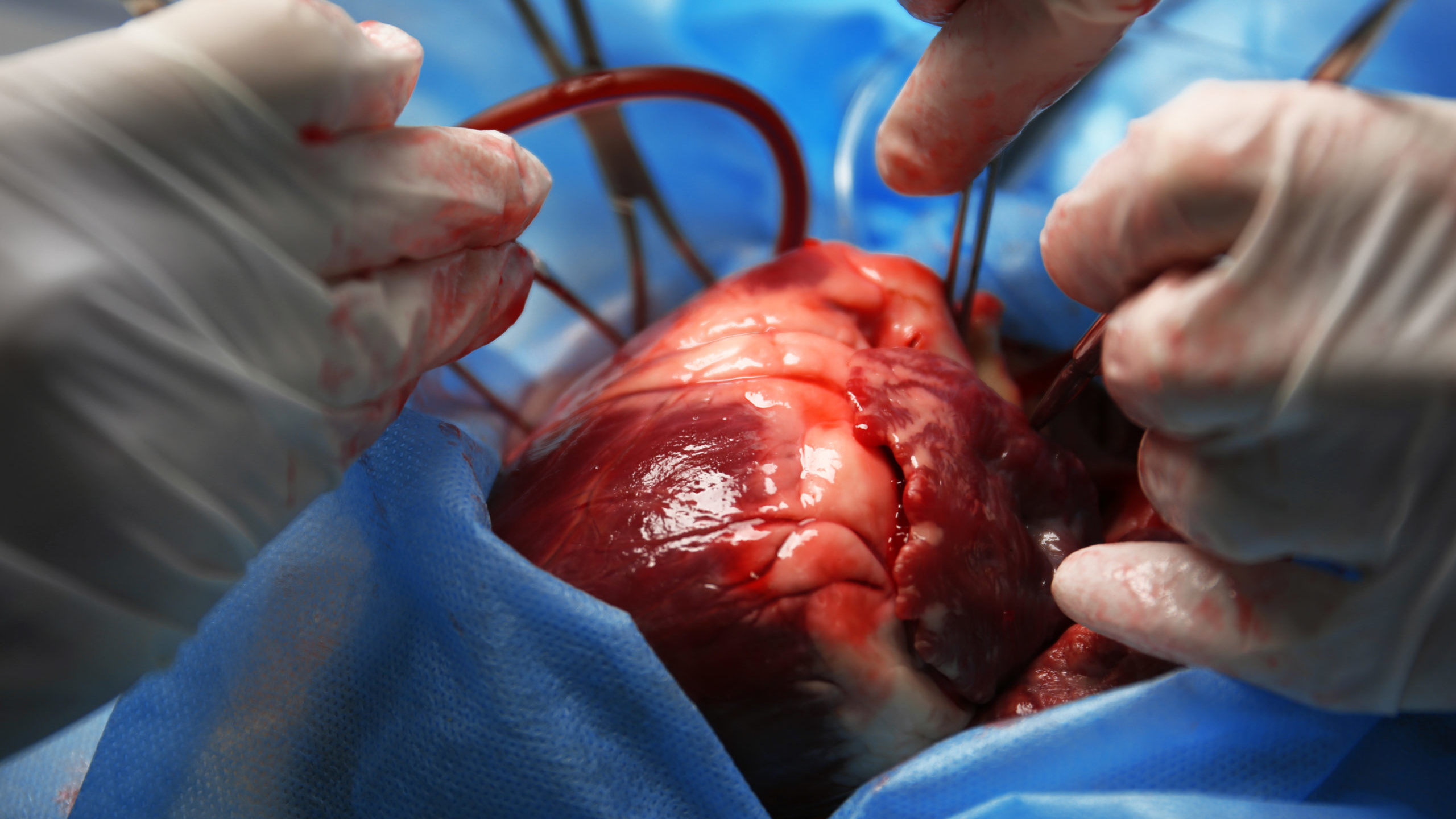 Doctor Doing Heart Operation