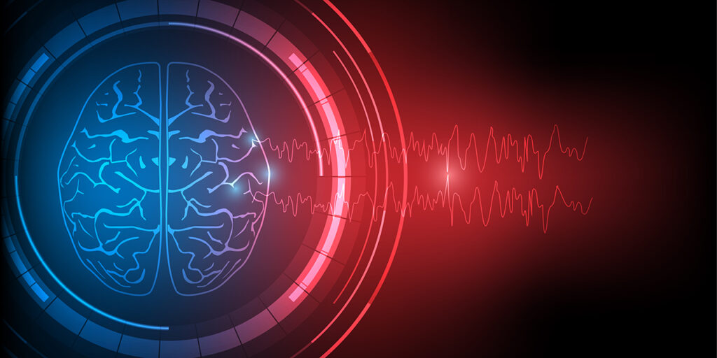 Illustration Of Human Epileptic Brain And Abnormal EEG Wave Disc